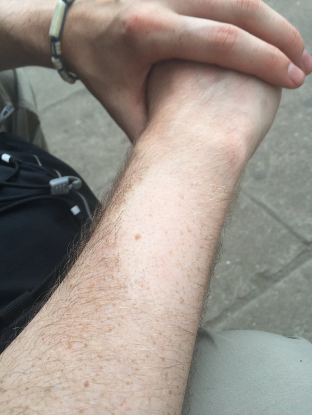 Where's your hair gone?